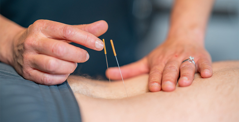 Dry-needling au cabinet PhysioÉvolution — vue 3